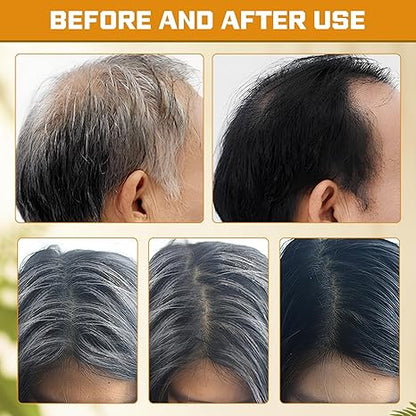 Black Hair Soap bar for Men and Women